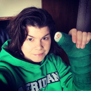 thumb-surgery